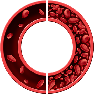 Compiles The Pain Phenotype Experienced By Patients - Anemia Clipart (367x367)