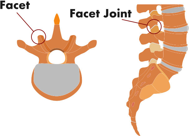 Hugh Acheson Brings A Chef Is Mind To The Slow Cooker, - Pain In Spine (976x496)