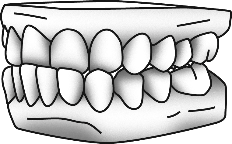 Denture Drawing - Denture Drawing (762x474)