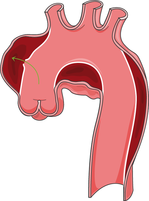 Arteries - Arteries (499x674)