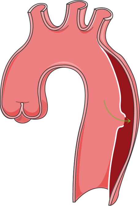 Arteries - Arteries (457x675)