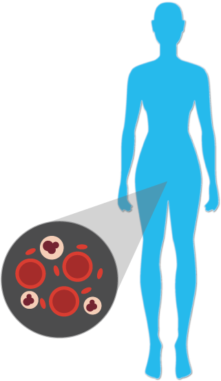Build Up Of Substances In Veins, The Deposit Of Plaque - Build Up Of Substances In Veins, The Deposit Of Plaque (327x553)