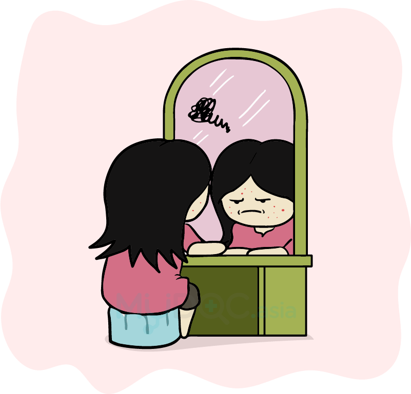 Acne Skin Too Much Pressure - Cartoon (801x769)