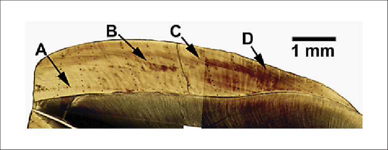 Low-power Photomontage Of M 1 In Male Baboon U9 - Canoe (778x301)