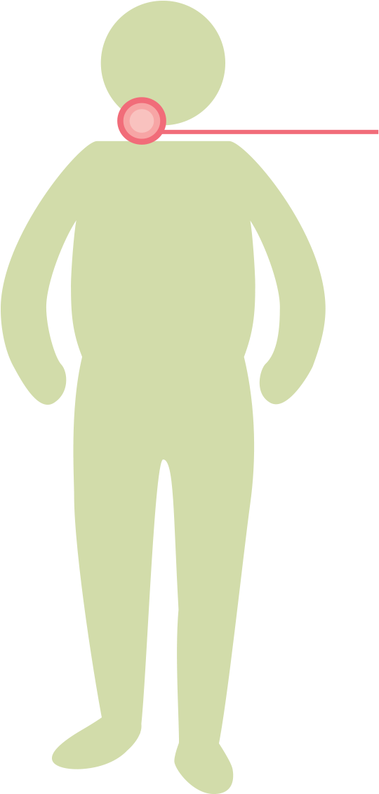 Suffer More Frequently From Frequent Throat Clearing - Illustration (572x1129)