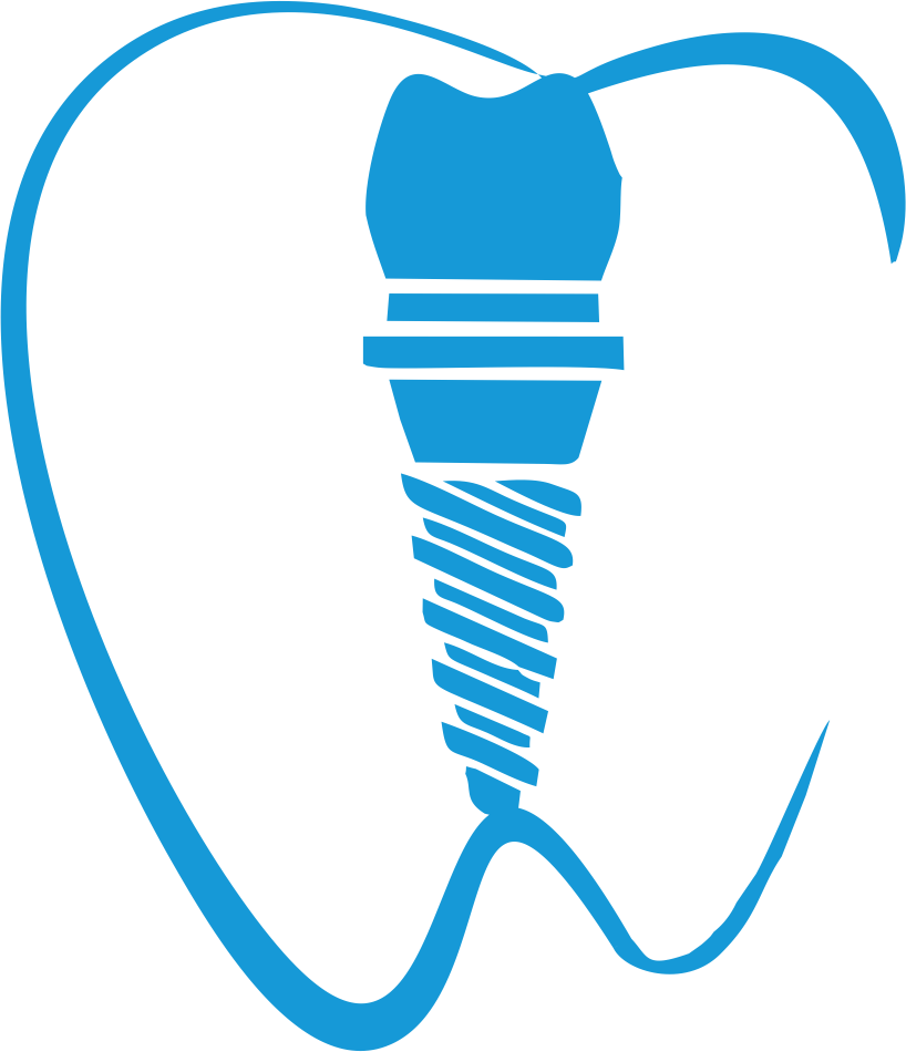 Dental Implant Dentistry Tooth Clip Art - Dental Implant Dentistry Tooth Clip Art (818x950)