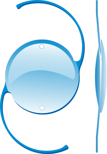 Single Piece Phaco Lens - Phaco Lens (346x500)