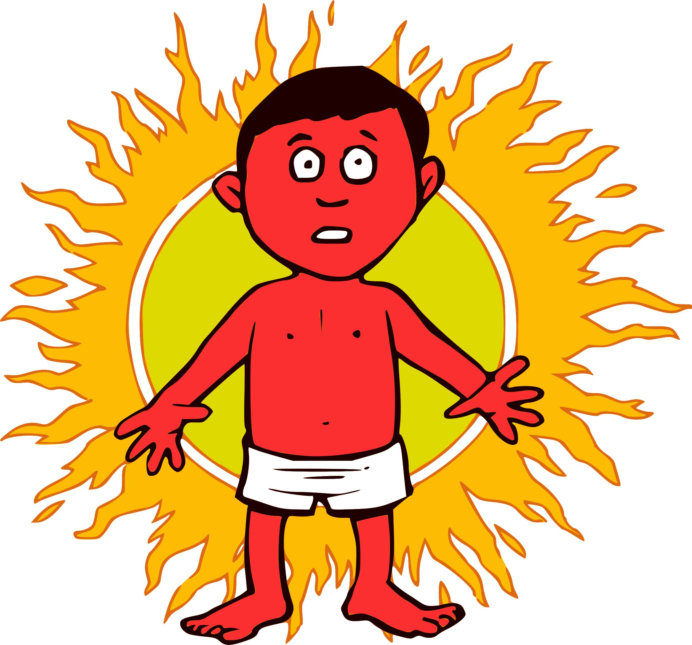 Sunburn Clipart - Sunburn Clipart (2400x2238)