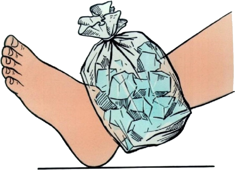 Applying Heat Or Ice Compression - Ice On Sprained Ankle (850x576)