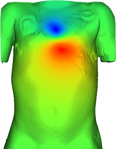 2 Year Old Torso Ischemic Potential Field - Active Shirt (452x539)