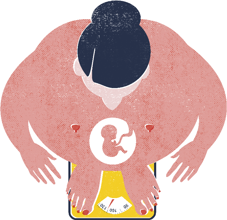 Pregnancy After Obesity Surgery Requires More Follow-up - Obesity In Pregnancy Cliparts (924x933)