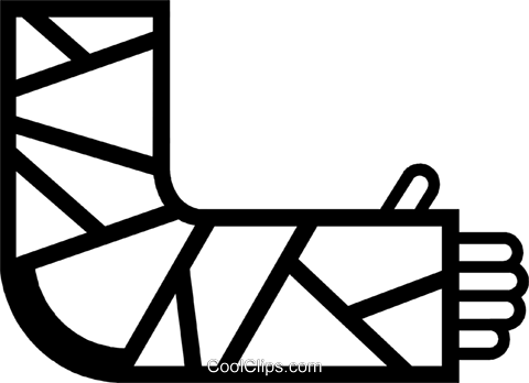 Broken Arm Royalty Free Vector Clip Art Illustration - Broken Arm Cast Clipart (480x348)