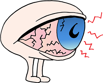 The First Type Is Due To The Eyes Not Producing Enough - Dry Syndrome Cartoon Eyes (400x400)