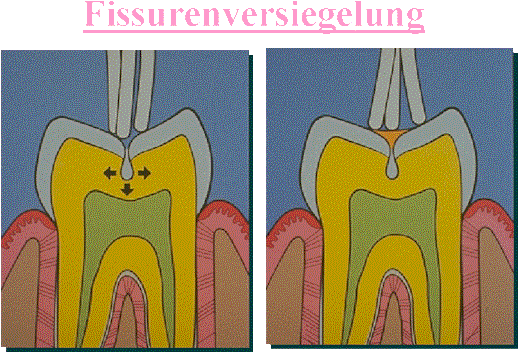 Die Fissur Ist - Tongue (531x381)