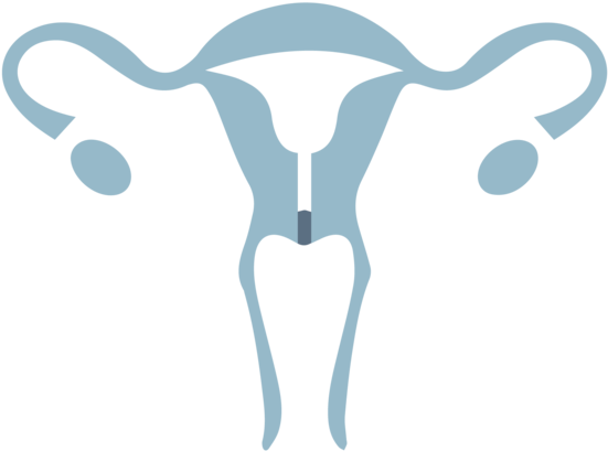 Cervical Cancer - Cervical Cancer (1000x750)