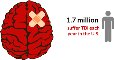 Common Causes Of Brain Injuries - Traumatic Brain Injury Png (484x252)