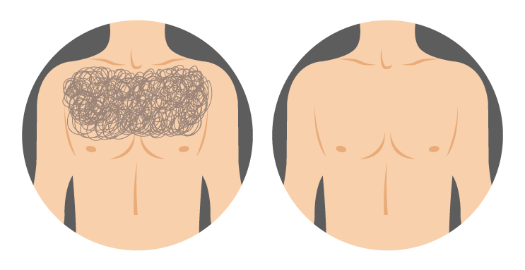 Skin Preparation - Illustration (771x414)