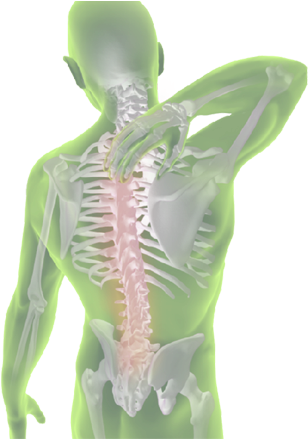 Musculoskeletal Disorders (338x438)