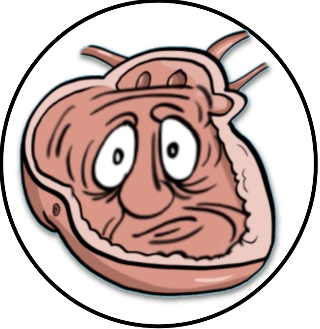 Causas De Fabrilación Auricular - Uu Chalice (654x672)