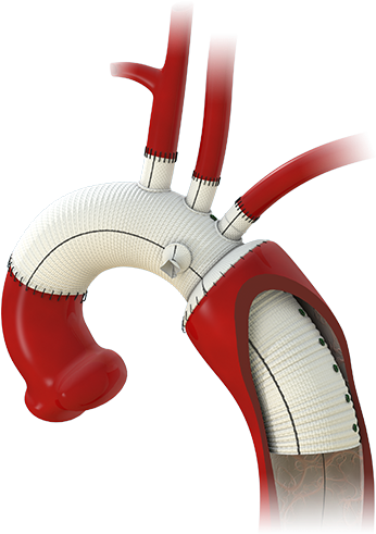 Gelweave Siena - Chair (800x500)