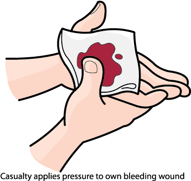 Apply First Aid Online Rh Nsfsakai Nthsydney Tafensw - Apply Pressure To Wound (393x367)