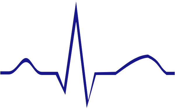 Normal Sinus Rhythm Clipart (600x375)
