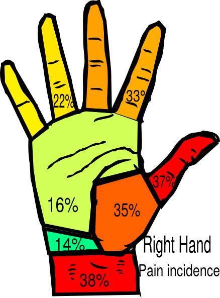 Right Hand Pain Incidence Surgeon Clip Art - Pain In Right Hand (438x593)
