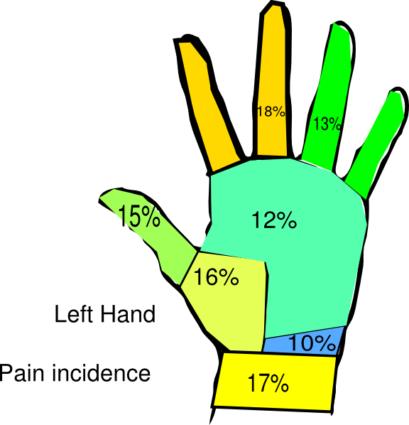 Left Hand Pain Incidence Surgeon Clip Art - Pain On Left Hand (576x598)