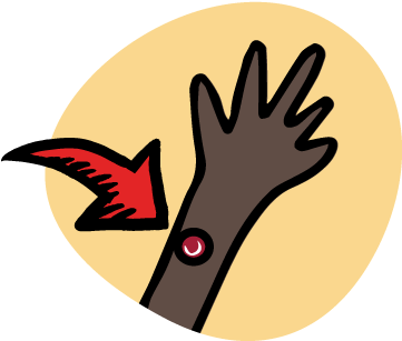 Symptoms To Look Out For - Rheumatic Fever Symptoms Picture Cartoon (422x312)