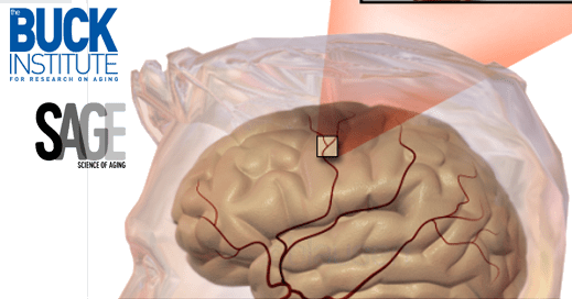 Buck Balance - Buck Institute For Research On Aging (519x272)