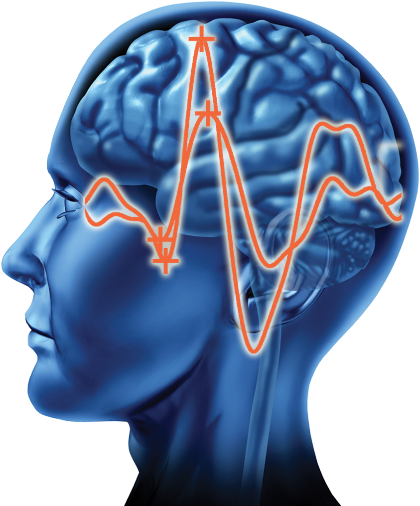 Research On Visual Evoked Potential And Mild Traumatic - Brain (855x1020)