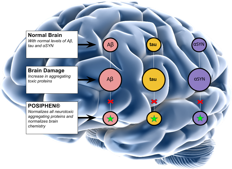 Our Pipeline - Alzheimer Ppt (960x720)