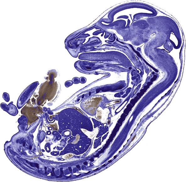 Rat Fetus - Sagittal Section Of Rat Embryo (593x579)