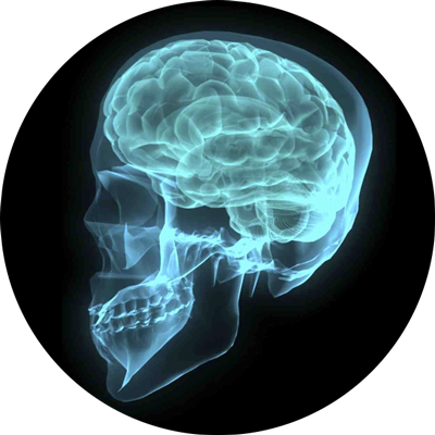 Drug Addicted Brain - Back From Brain Aneurysm (400x400)