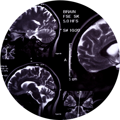 Diagnosis And Treatmentlearn More - Traumatic Brain Injury (392x392)