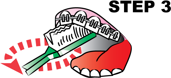 Make Sure You Slowly Brush Every Tooth And The Arches - Tooth Brushing (600x300)