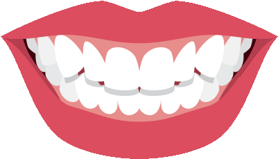 Image Result For Red Lip White Teeth Animated - Animated Pictures Of Teeth (400x400)