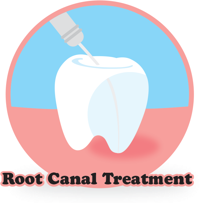 Scaling & Polishing - Apple (663x675)
