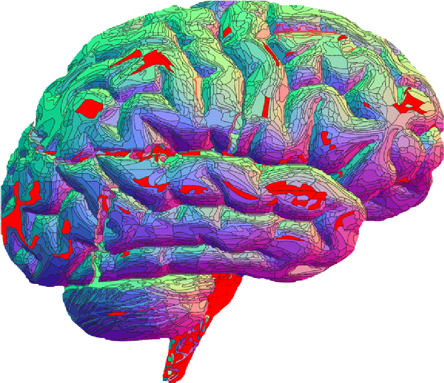 This Is What Asperger's Syndrome Is Like - Brain Gif Tumblr Transparent (1215x1043)