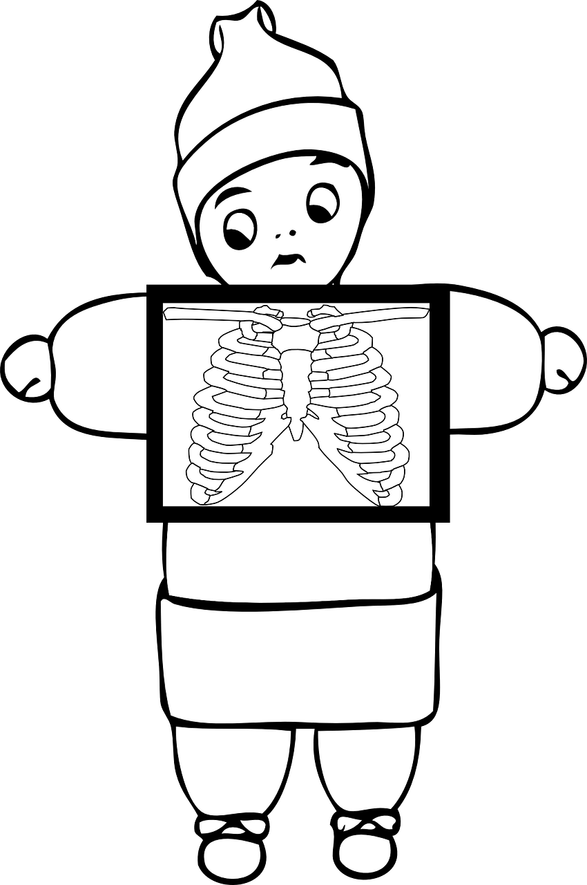 My Last Anatomy Session - Outline Picture Of X Ray (850x1280)
