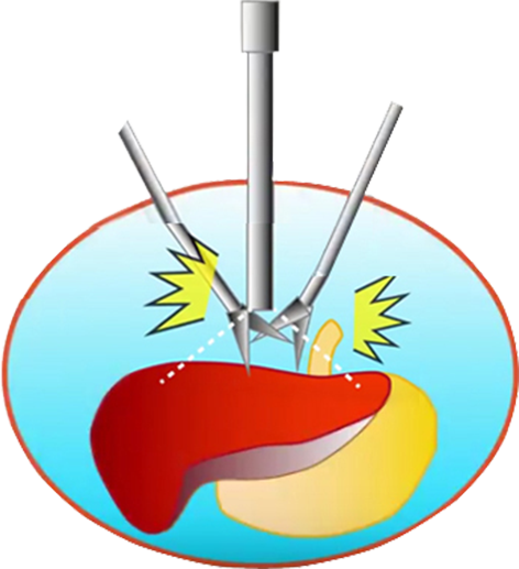 ［conventional 2k］conventional Devices Require Closer - ［conventional 2k］conventional Devices Require Closer (472x517)