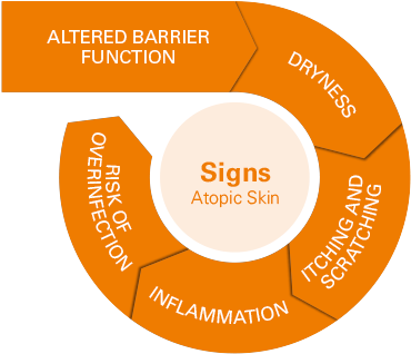 Improves And Prevents Signs Associated With Atopic - Ciclo De La Dermatitis Atopica (438x368)
