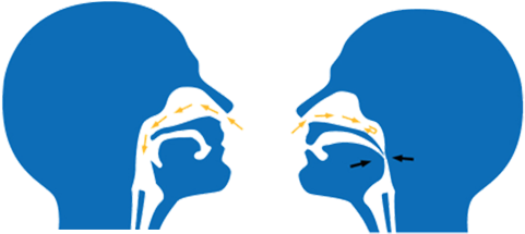 Identifying Sleep Apnea At Integrative Family Dentistry - Identifying Sleep Apnea At Integrative Family Dentistry (600x235)