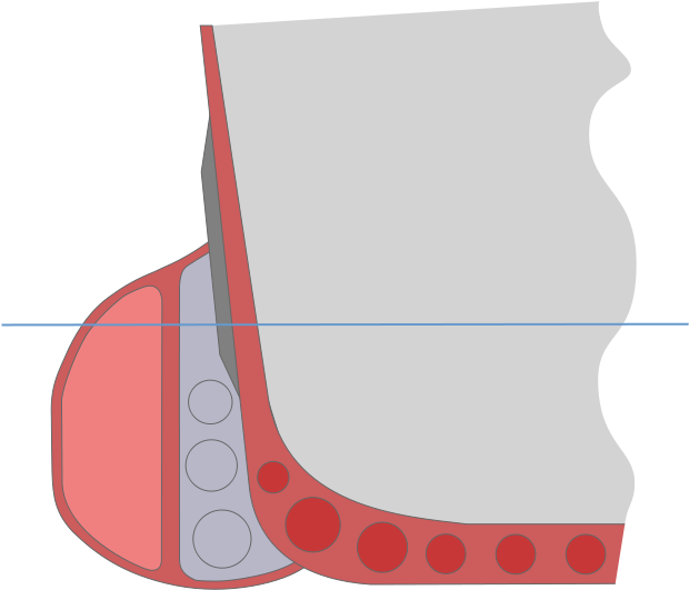 File - Anti-torpedo Bulge - Svg - Anti Torpedo Blister (752x555)