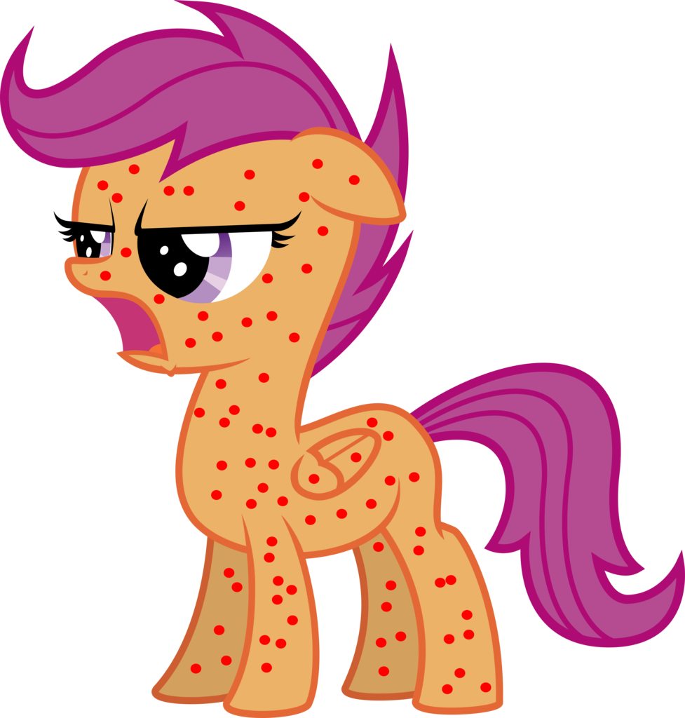 Apony4u, Chicken Pox, Disease, Hives, Irony, Measles, - Chicken Pox Cartoon Png (1024x1074)