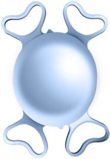 Quatrix® Aspheric Evolutive Intraocular Lens - Acrylic Acid (480x327)