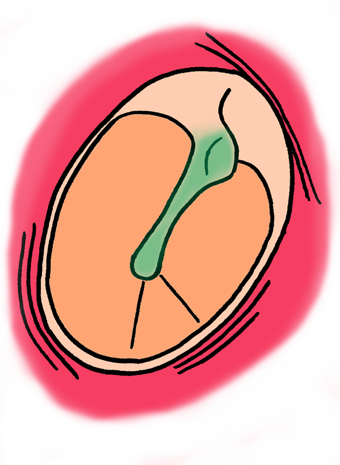 Grommet Anatomy - Grommet Anatomy (700x956)
