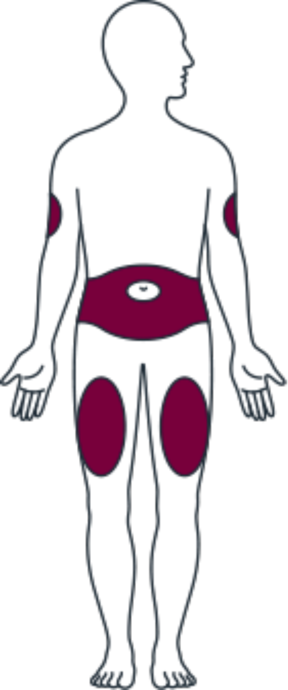 Front Side Appropriate Injection Sites - Arm (586x1400)