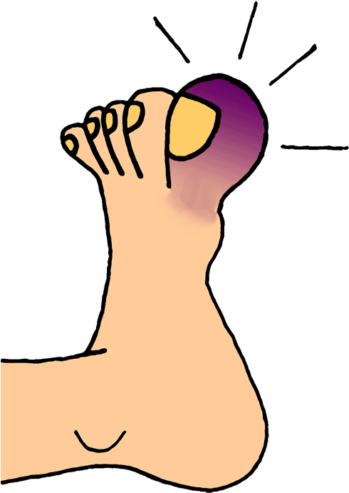 Perfect World Clip Art Healthcare - Shoe (500x706)