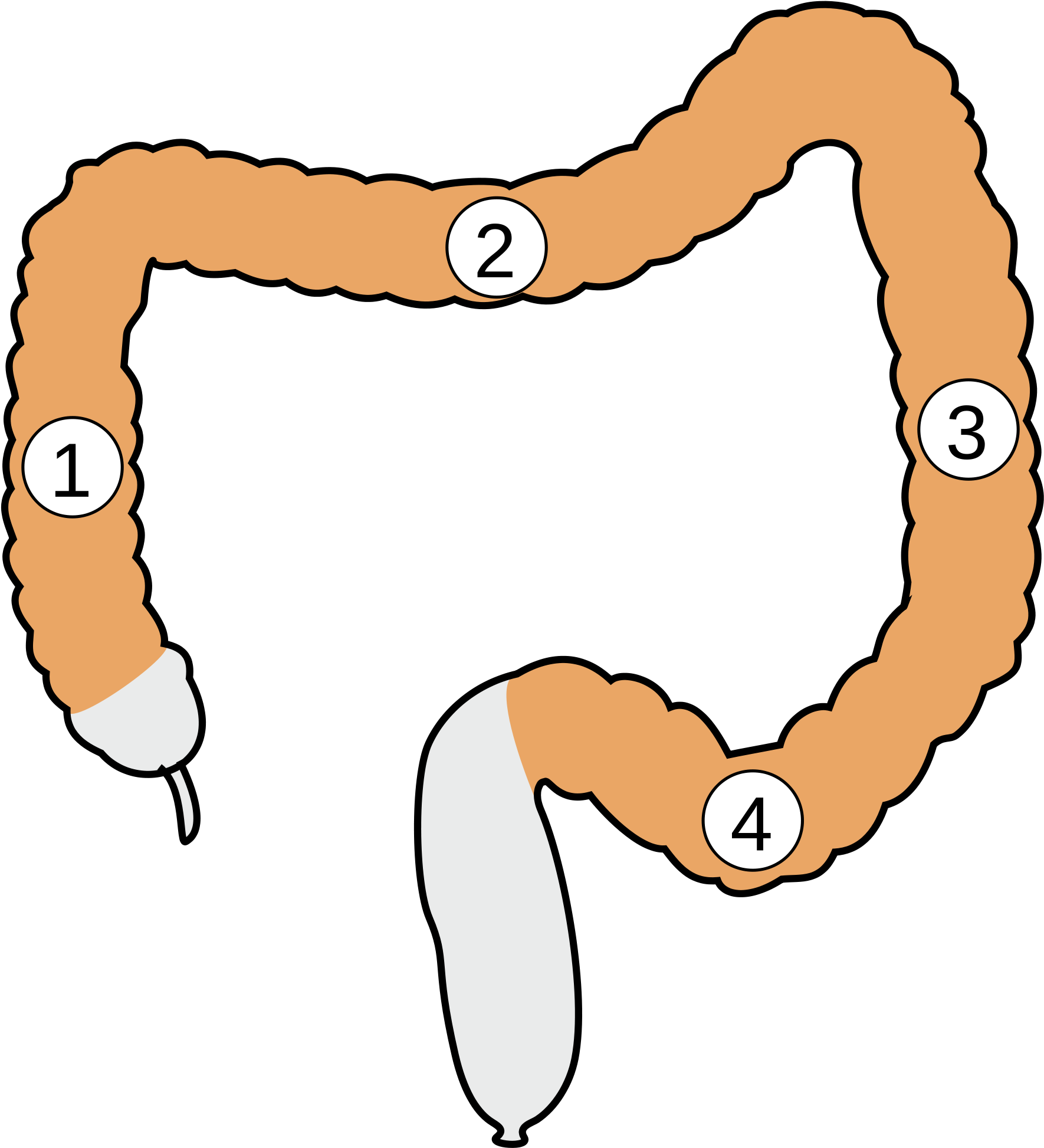 Open - Large Intestine (2000x2143)